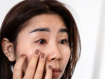 Safe And Soothing Eye Infection Remedies For All Ages