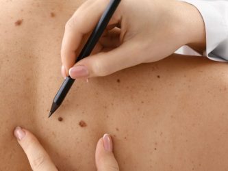 Skin cancer prevention guide